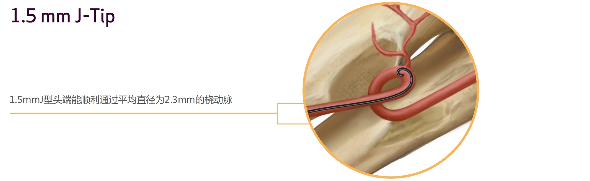 血管造影导丝